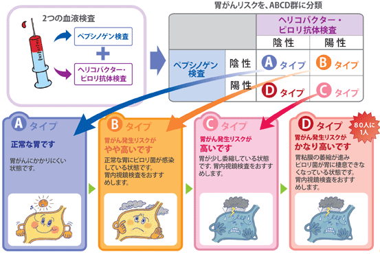 胃がんＡＢＣ検査