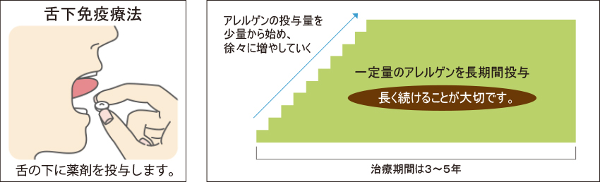 スギ花粉症舌下免疫療法